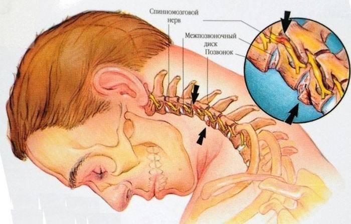 هيكل منطقة عنق الرحم أسفل الرأس
