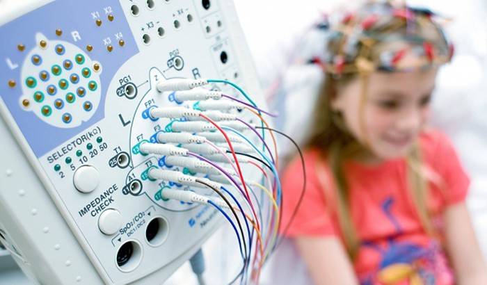 EEG ของสมองของเด็ก