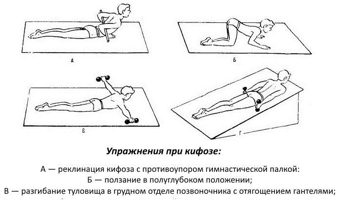 Терапеутске вежбе
