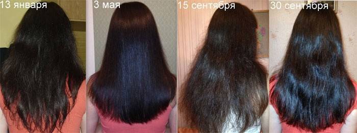 Crescita dei capelli da Dimexidum