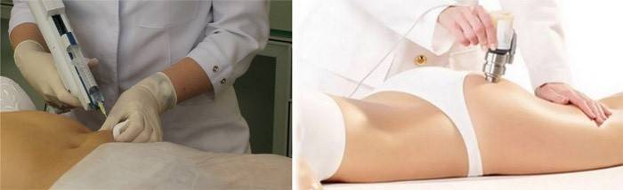 Sự ra đời của một loại cocktail lipolytic