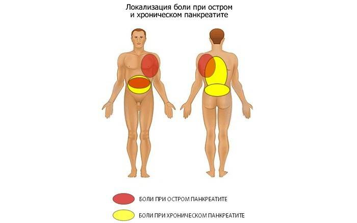 Локализация на болката по време на атака
