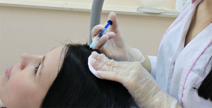 Mes Liệu pháp để loại bỏ gàu