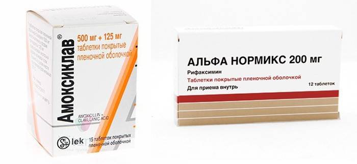 Thuốc điều trị bệnh túi thừa đại tràng sigma