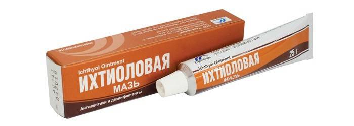 Ichtiolio tepalas
