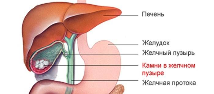 Како изгледа жучна болест?