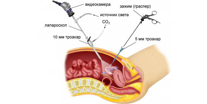 Thủ tục nội soi