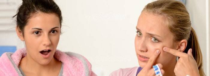 Mụn trứng cá tuổi teen cần được chăm sóc đặc biệt