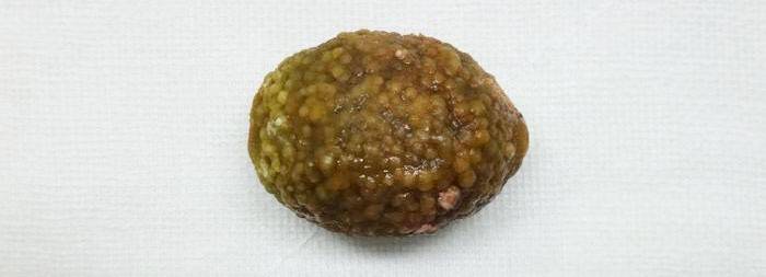 דוגמה לאבן גדולה