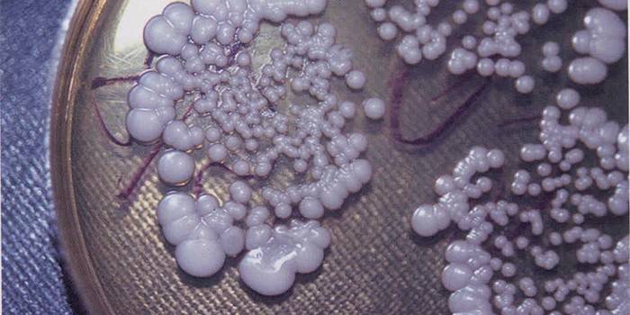 Candidiasis colpitis
