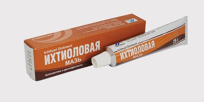 Ицхтхиол маст из вен-а на тијелу