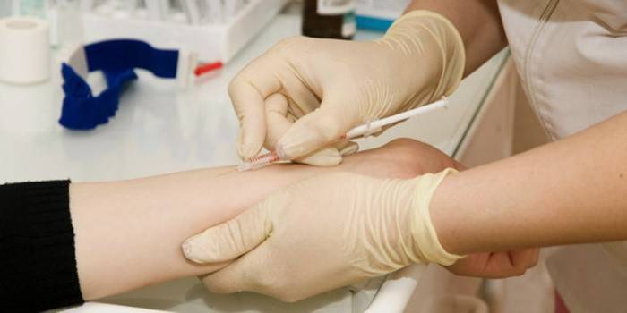 Kapalı tüberküloz formunu belirlemek için Mantoux testi