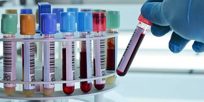 Tubes de sang pour analyse