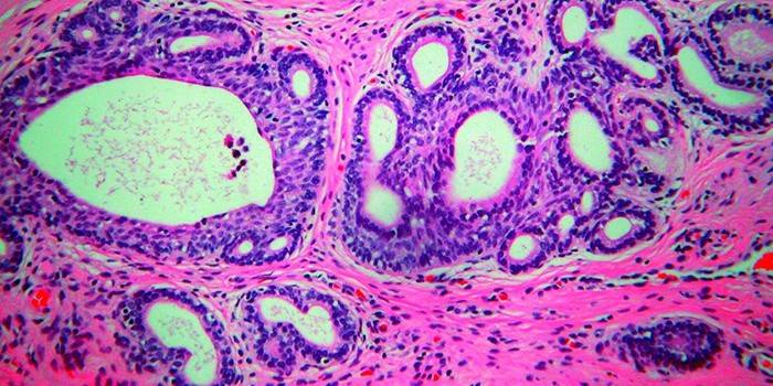 Bactérias Trichomonas