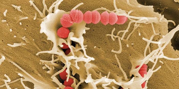 Bactérias Streptococcus