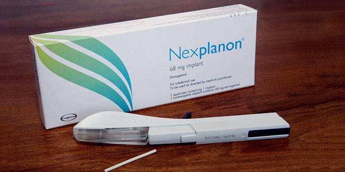 Empfängnisverhütendes Implantat für Männer