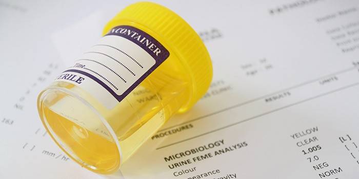 analisi delle urine
