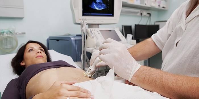 Femeie supusă examinării ecografice a organelor abdominale