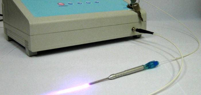 Laser chirurgical de tumeur