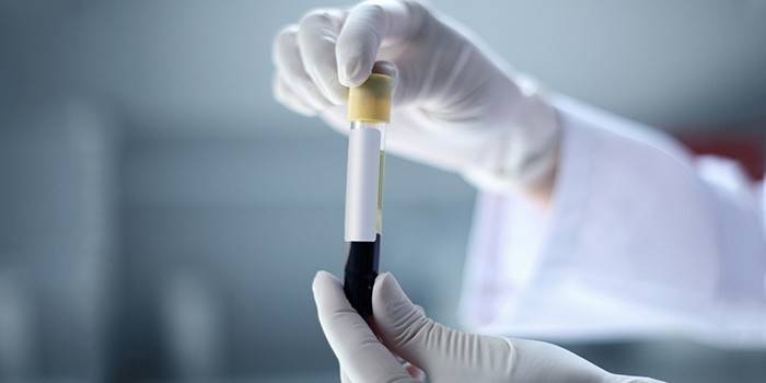 Sang in vitro pour analyse.