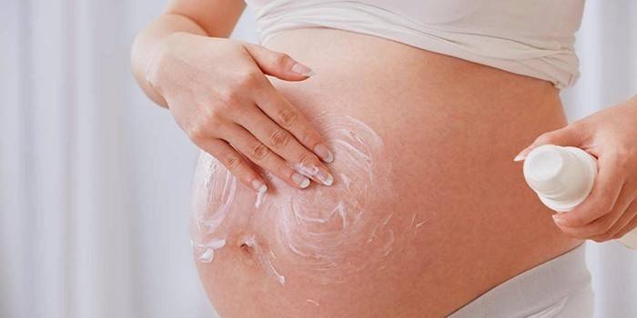 Woman struggling with stretch marks on her stomach