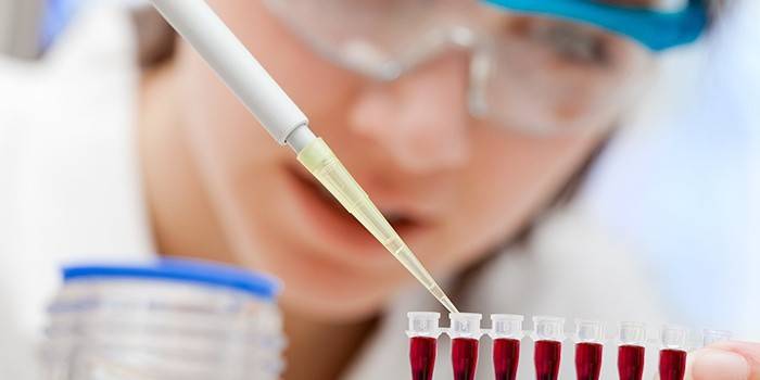 Tehnicianul de laborator examinează testele