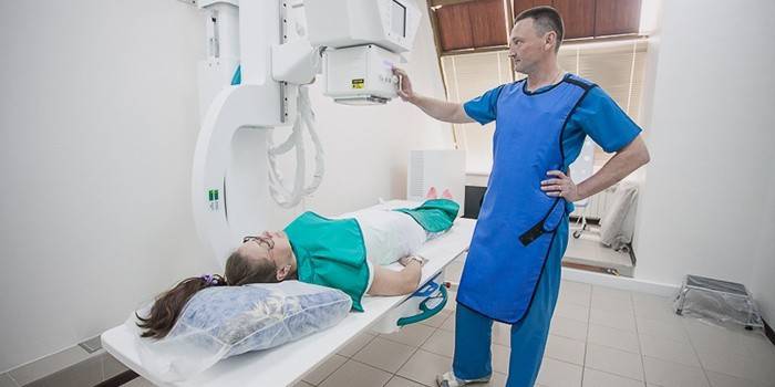 Hysterosalpingoscopy để chẩn đoán sa tử cung