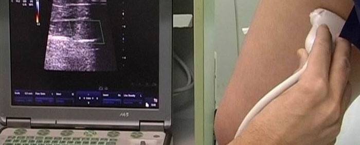 Diagnostika aterosklerózy ciev dolných končatín