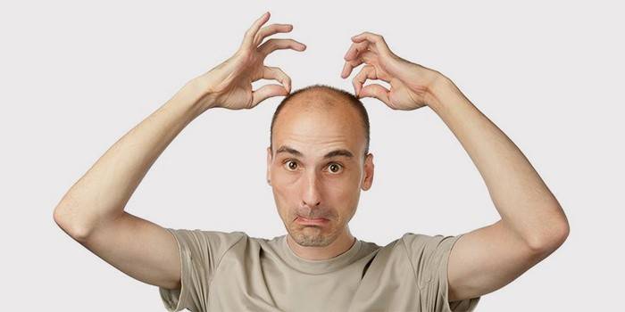 Homme avec une tête chauve