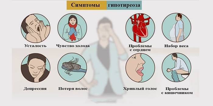 Skydliaukės hipotireozės simptomai
