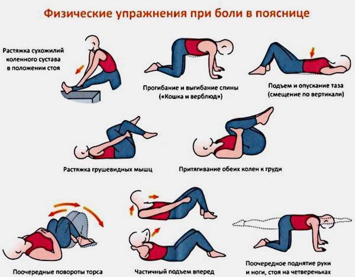 Điều trị dự phòng đau thần kinh tọa