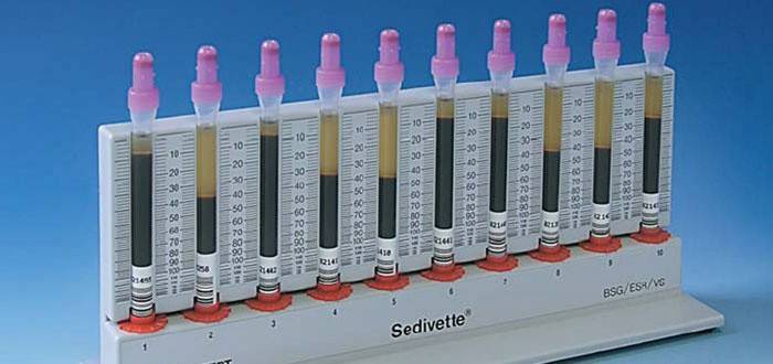 ESR tests
