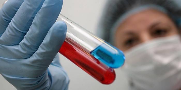 Pagsubok ng dugo para sa HIV