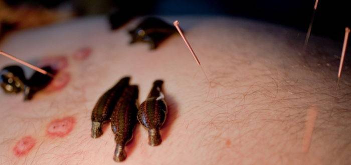 Leech-merkit