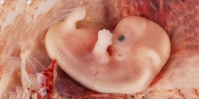 Fetus de dos mesos