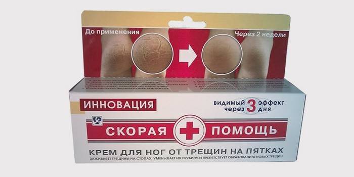 Ambulância de creme para pés