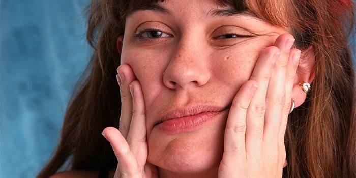 Uma mulher tem neurite facial