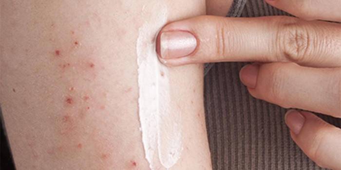 Crème pour la peau