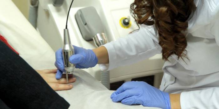 Điều trị nấm bằng laser