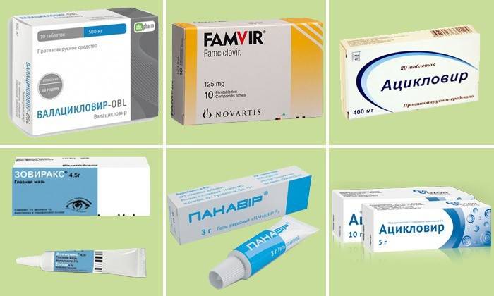Rimedi per l'herpes labiale