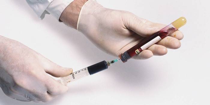 Cholesterinspiegel im Blut