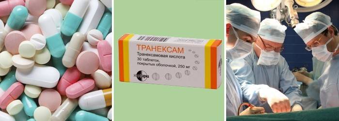 Как да спрем кръвта