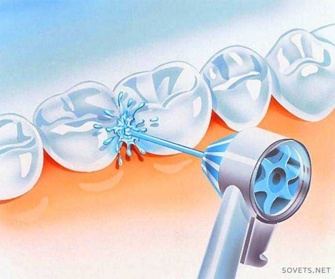 Travail d'irrigateur