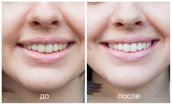 Resultado de procedimento