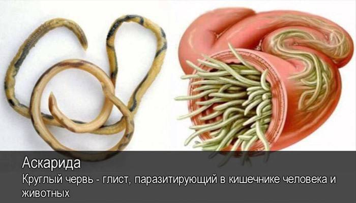 الديدان المستديرة - الطفيليات في جسم الإنسان