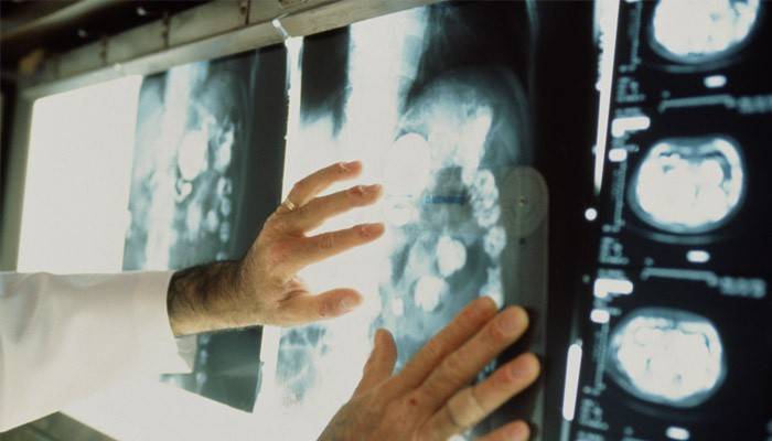 Il medico esamina i risultati della tomografia.