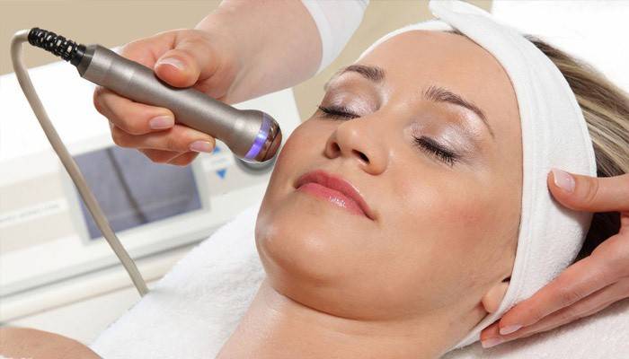Lazer rosacea giderimi