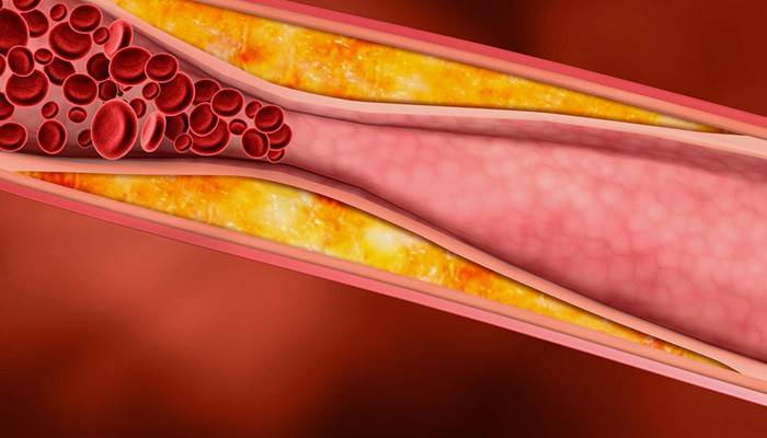 Colesterol en sangre