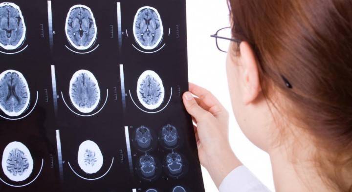 Vainikinių arterijų ligos diagnozė