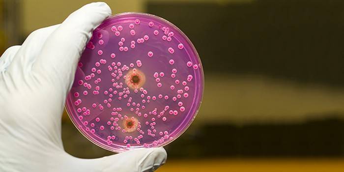 Candida sēnīte